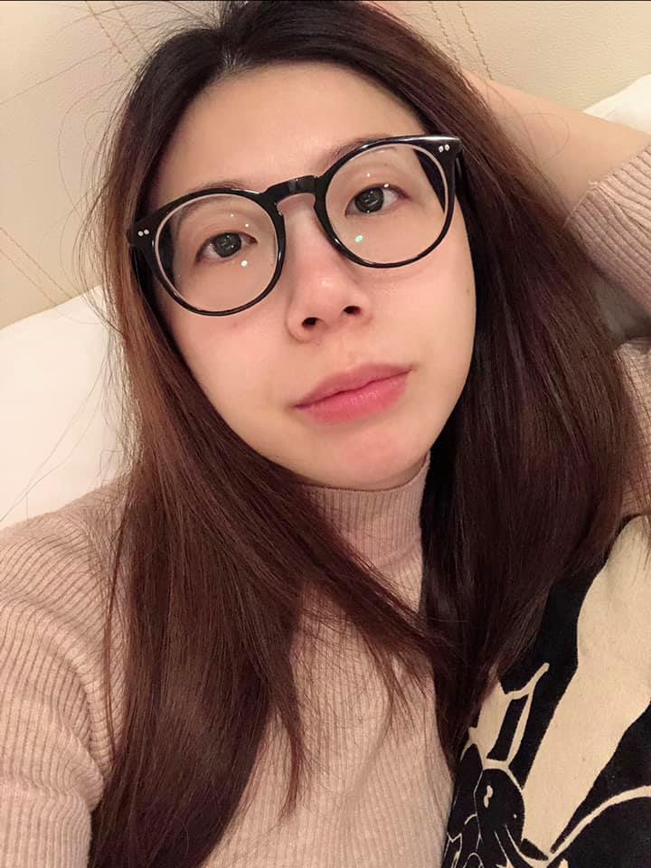 【皮秒雷射】星和診所-桃園市-每次長完痘都會色素沈澱超嚴重 ，所以必須要來淡化一下，打完隔天超有感！！！～-胡如意